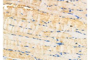 ABIN6264868 and ABIN6277492 at 1/100 staining Rat muscle tissue by IHC-P. (RRM2 antibody  (C-Term))