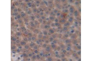 Figure. (APOC3 antibody  (AA 21-101))