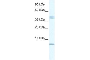 Western Blotting (WB) image for anti-Ts Translation Elongation Factor, Mitochondrial (TSFM) antibody (ABIN2460533)