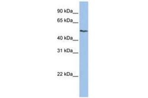 SLC16A6 anticorps  (AA 288-337)
