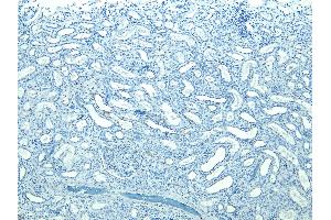 (ABIN184697) Negative Control showing staining of paraffin embedded Human Kidney, with no primary antibody. (STUB1 antibody  (C-Term))