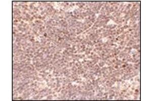 Immunohistochemistry of S1P1 in Mouse thymus tissue with EDG-1 / S1PR1 antibody at 5 μg/ml. (S1PR1 antibody  (C-Term))