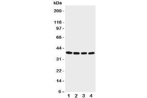 Western blot testing of EIF2B antibody and Lane 1:  M451;  2: Jurkat;  3: HeLa;  4: 293T cell lysate.