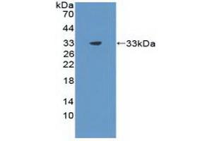 Detection of Recombinant CIDEC, Rat using Polyclonal Antibody to Cell Death Inducing DFFA Like Effector C (CIDEC)