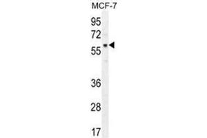AKT1 Antibody (pT450) western blot analysis in MCF-7 cell line lysates (35 µg/lane). (AKT1 antibody  (C-Term))