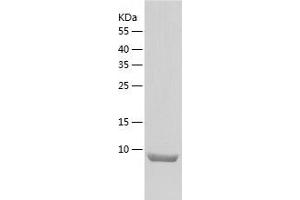 Western Blotting (WB) image for Polymerase (DNA-Directed), delta 4, Accessory Subunit (POLD4) (AA 1-107) protein (His tag) (ABIN7288913) (POLD4 Protein (AA 1-107) (His tag))