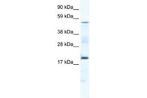 CSNK1G1 antibody (20R-1168) used at 0. (CSNK1G1 antibody  (Middle Region))