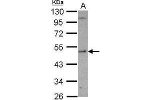 WB Image Sample (30 ug of whole cell lysate) A: U87-MG 10% SDS PAGE antibody diluted at 1:1000 (SHMT1 antibody)