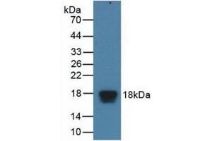 Detection of Recombinant EIF4EBP1, Human using Polyclonal Antibody to Eukaryotic Translation Initiation Factor 4E Binding Protein 1 (EIF4EBP1) (eIF4EBP1 antibody  (AA 2-118))