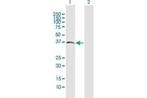 Western Blot analysis of ACVR2B expression in transfected 293T cell line by ACVR2B MaxPab polyclonal antibody. (ACVR2B antibody  (AA 1-303))