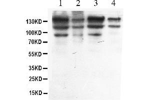 Western blot analysis of ADAR1 expression in HELA whole cell lysates ( Lane 1), A549 whole cell lysates ( Lane 2), MCF-7 whole cell lysates ( Lane 3) and HEPG2 whole cell lysates ( Lane 4). (ADAR antibody  (AA 128-346))
