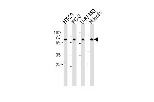 Western blot analysis of lysates from HT-29, PC-3, U-87 MG cell line and human testis tissue lysate(from left to right), using OASL Antibody  (ABIN390168 and ABIN2840664). (OASL antibody  (C-Term))