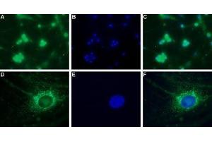 Expression of CaV3. (CACNA1H antibody  (Intracellular Loop))