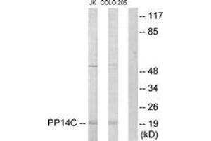 Western blot analysis of extracts from Jurkat/COLO205 cells, using PPP1R14C Antibody. (PPP1R14C antibody  (AA 51-100))