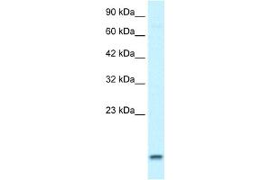 WB Suggested Anti-UBE2N Antibody Titration:  1. (UBE2N antibody  (Middle Region))