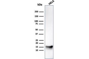 Western Blotting (WB) image for anti-Fatty Acid Binding Protein 5 (Psoriasis-Associated) (FABP5) antibody (ABIN6939368)