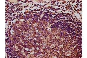 IHC image of ABIN7166787 diluted at 1:400 and staining in paraffin-embedded human lymph node tissue performed on a Leica BondTM system. (IBA57 antibody  (AA 286-356))