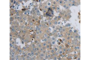 Immunohistochemistry (IHC) image for anti-Creatine Kinase, Mitochondrial 1A (CKMT1A) antibody (ABIN5546002) (CKMT1A antibody)
