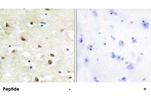 Immunohistochemistry analysis of paraffin-embedded human brain tissue using HNRNPC polyclonal antibody .