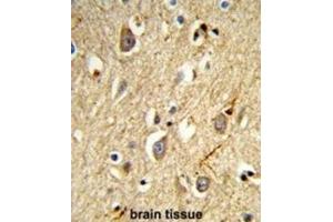 Immunohistochemistry (IHC) image for anti-RAB8A, Member RAS Oncogene Family (RAB8A) antibody (ABIN3003984) (RAB8A antibody)