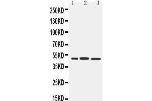 Anti-IRF8 antibody, Western blotting Lane 1: RAJI Cell Lysate Lane 2: Rat Liver Tissue Lysate Lane 3: Rat Kidney Tissue Lysate