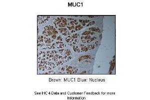 Immunohistochemistry (IHC) image for anti-Mucin 1 (MUC1) (C-Term) antibody (ABIN2776819)