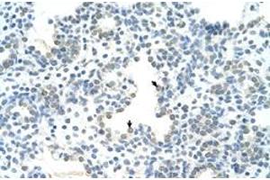 Immunohistochemical staining (Formalin-fixed paraffin-embedded sections) of human lung with HOXC10 polyclonal antibody  at 4-8 ug/mL working concentration. (HOXC10 antibody  (N-Term))