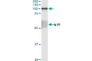 Immunoprecipitation of RAPGEF3 transfected lysate using anti-RAPGEF3 MaxPab rabbit polyclonal antibody and Protein A Magnetic Bead , and immunoblotted with RAPGEF3 MaxPab rabbit polyclonal antibody (D01) . (RAPGEF3 antibody  (AA 1-881))