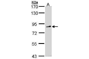 WB Image Sample (30 ug of whole cell lysate) A: Molt-4 , 7. (FGD4 antibody)