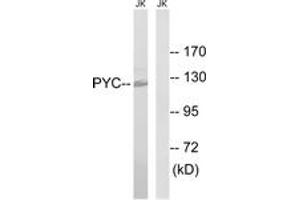 Western blot analysis of extracts from Jurkat cells, using PC Antibody. (PC (AA 357-406) antibody)