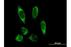 Immunofluorescence of purified MaxPab antibody to PLOD2 on HeLa cell. (PLOD2 antibody  (AA 1-758))