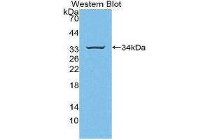 Western Blotting (WB) image for anti-Signal Transducing Adaptor Molecule (SH3 Domain and ITAM Motif) 1 (STAM) (AA 196-465) antibody (ABIN2117564) (STAM antibody  (AA 196-465))