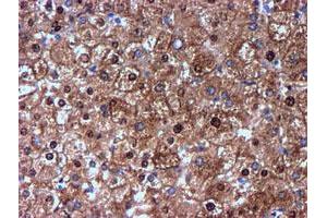 Immunohistochemical staining of paraffin-embedded Human liver tissue using anti-NNMT mouse monoclonal antibody.