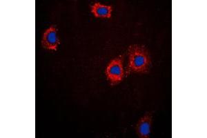 Immunofluorescent analysis of cTnI staining in A431 cells. (TNNI3 antibody  (Center))