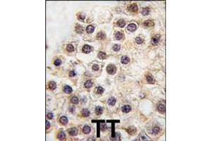 Formalin-fixed and paraffin-embedded human testis tissue reacted with ARIDB3 antibody , which was peroxidase-conjugated to the secondary antibody, followed by DAB staining.
