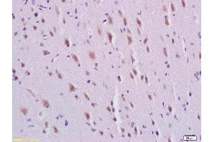 Formalin-fixed and paraffin embedded rat brain labeled with Rabbit Anti-PDGFBB Polyclonal Antibody, Unconjugated  at 1:200 followed by conjugation to the secondary antibody and DAB staining (PDGF-BB Homodimer (AA 151-241) antibody)