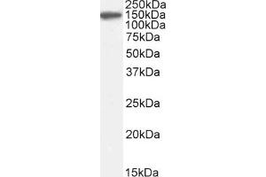 Western Blotting (WB) image for anti-Complement Factor H (CFH) (Internal Region) antibody (ABIN185437)