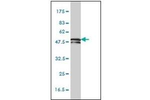 Western Blotting (WB) image for anti-Keratin 81 (KRT81) (AA 1-203) antibody (ABIN614629) (KRT81 antibody  (AA 1-203))