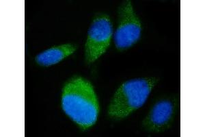 IF analysis of SND1 using anti-SND1 antibody (ABIN7600526).