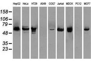 Western blot analysis of extracts (35 µg) from 9 different cell lines by using anti-CHEK2 monoclonal antibody. (CHEK2 antibody)