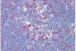 Human Thymus (formalin-fixed, paraffin-embedded) stained with TYMS antibody ABIN293172 at 5 ug/ml followed by biotinylated secondary antibody, alkaline phosphatase-streptavidin and chromogen. (TYMS antibody)