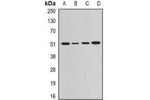 Western blot analysis of GDA expression in Hela (A), SKOV3 (B), mouse lung (C), rat brain (D) whole cell lysates. (GDA antibody)