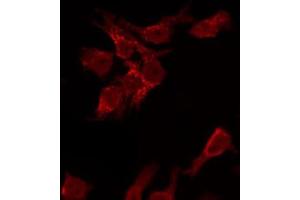 ABIN6267474 staining HeLa by IF/ICC. (AKT1 antibody  (pSer473))