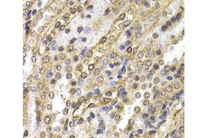 Immunohistochemistry of paraffin-embedded Rat kidney using NEDD9 Polyclonal Antibody at dilution of 1:200 (40x lens). (NEDD9 antibody)