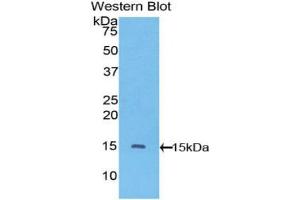 Western blot analysis of the recombinant protein. (VEGFC antibody  (AA 108-223))