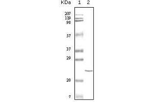 Western Blot showing cTnI antibody used against truncated cTnI recombinant protein.