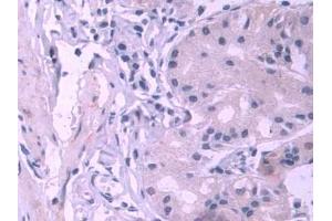 DAB staining on IHC-P; Samples: Human Stomach Tissue (PES1 antibody  (AA 1-415))