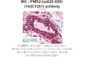Image no. 1 for anti-PMS2 Postmeiotic Segregation Increased 2 (S. Cerevisiae) (PMS2) (AA 623-639) antibody (ABIN5693679) (PMS2 antibody  (AA 623-639))