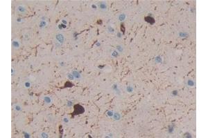Detection of CR in Human Brain Tissue using Polyclonal Antibody to Calretinin (CR) (Calretinin antibody  (AA 28-248))