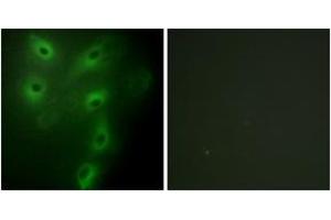 Immunofluorescence analysis of HeLa cells, using TRIM59 Antibody. (TRIM59 antibody  (AA 191-240))